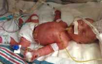 26 недель беременности: развитие плода и ощущения женщины