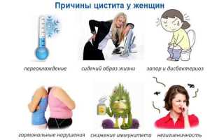 Польза упражнений во время цистита