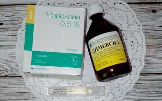 Лечение пяточной шпоры Димексидом – рецепты компрессов