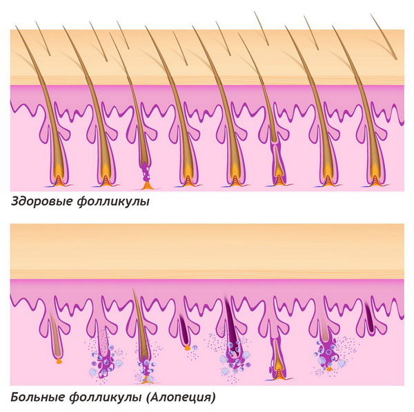 волосяные фолликулы
