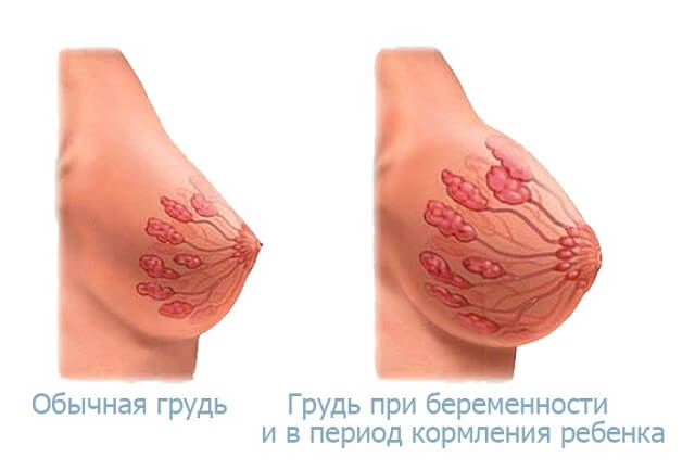 набухание молочных желез