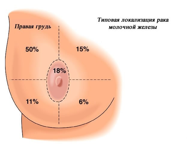 локализация зон груди